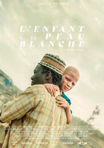 L'enfant a la peau blanche