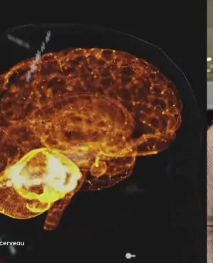 Enquêtes de région - les mystères du cerveau, avec Sylvie Malal 