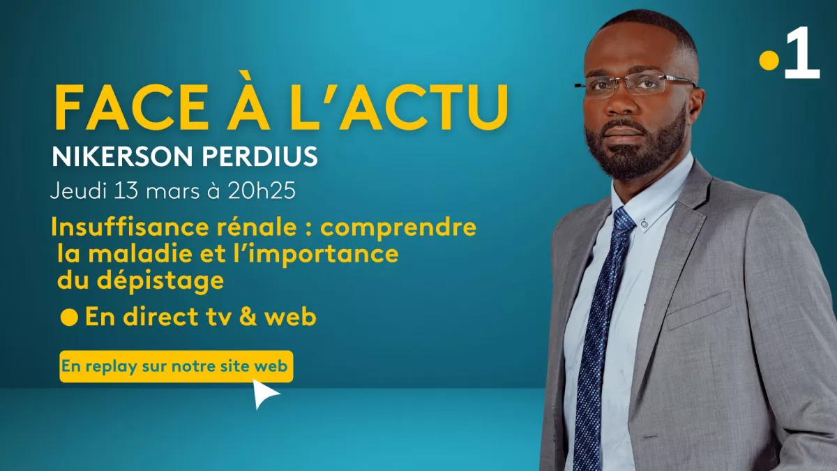 face actu