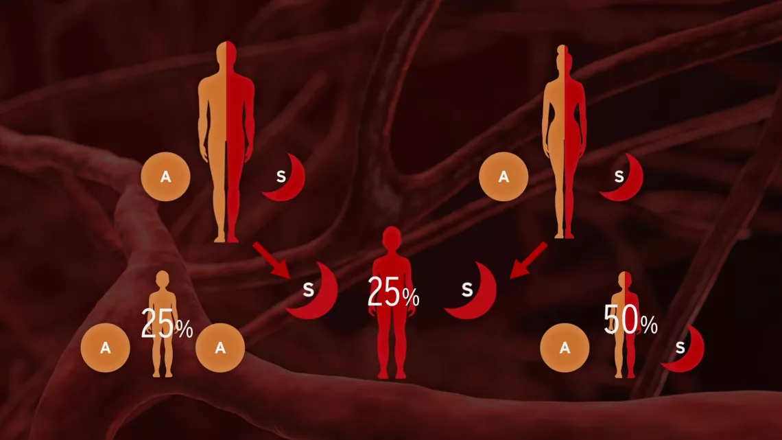 Drépanocytose : La douleur en héritage